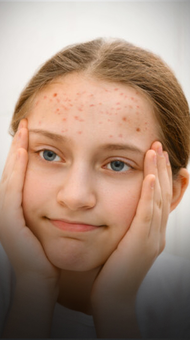 Advanced carbon laser peel for glowing and rejuvenated skin at Skinpal Kakkanad